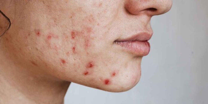 Blog Aromatico 8